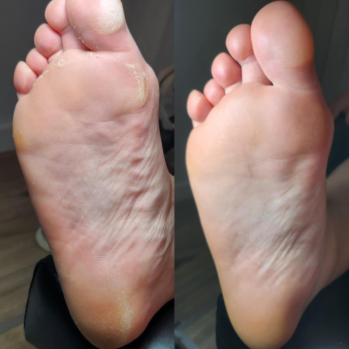 Footlogix Spa
